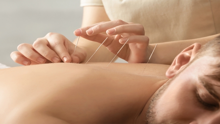Acupuncture And Traditional Chinese Medicine For Holistic Wellness