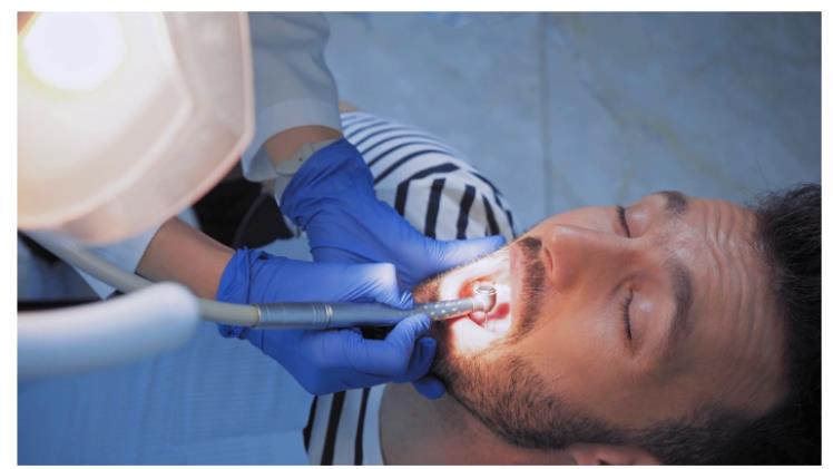 Unlocking the Secrets to a Flawless Smile with Dental Implants