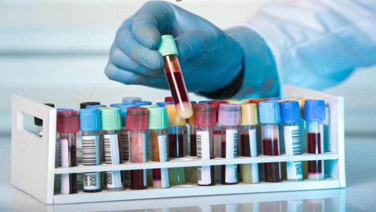 The Role of PK Testing in Personalized Medicine: Tailoring Treatment for Patients